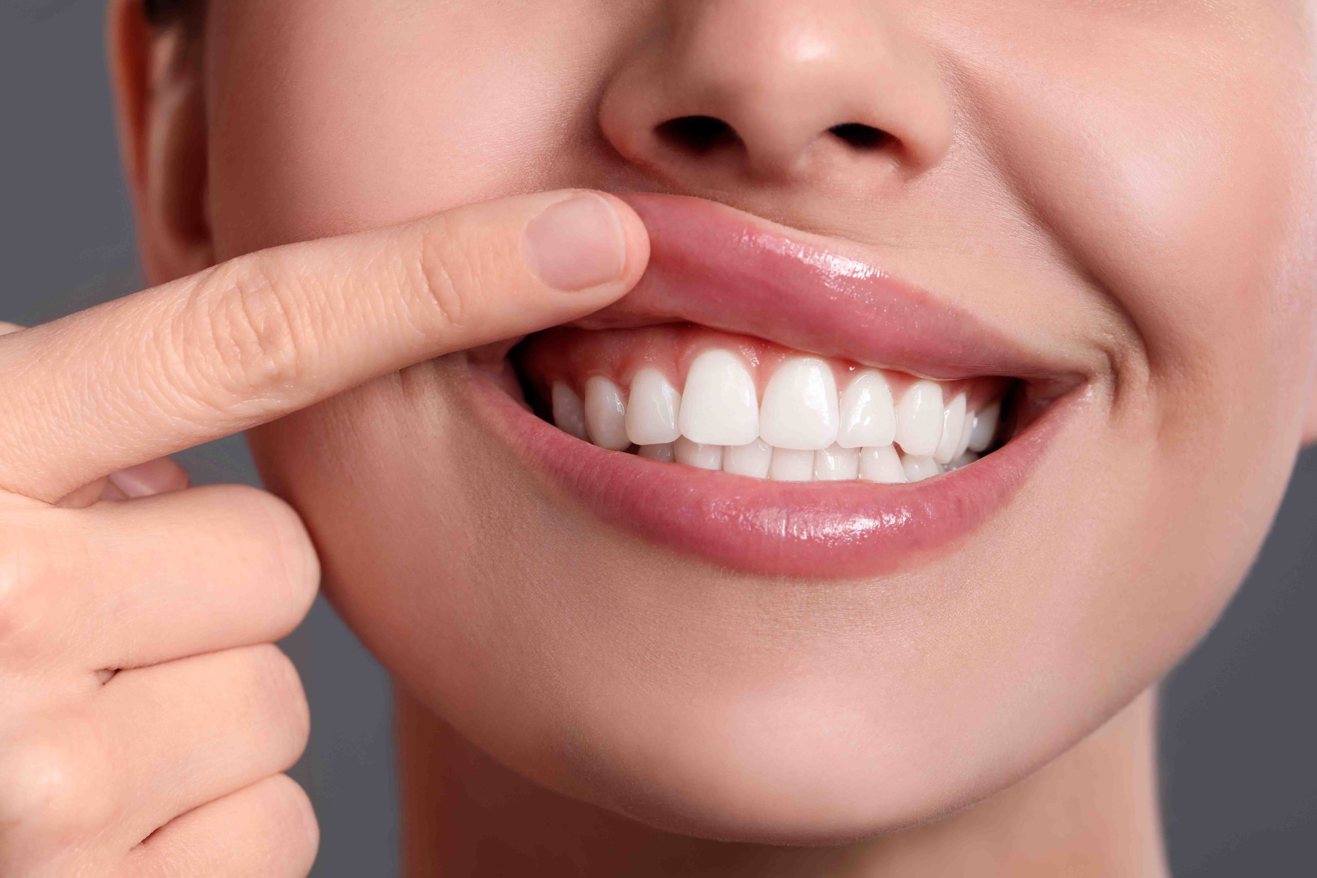 Gingivectomie à Casablanca : remodelage des gencives à la Clinique Dentaire La Colline